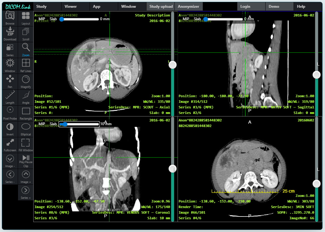 SecurePACS DICOM viewer in dark mode with a four-viewport layout showing CT axial, sagittal, and coronal views, a toolbar across the top, and series thumbnails on the side